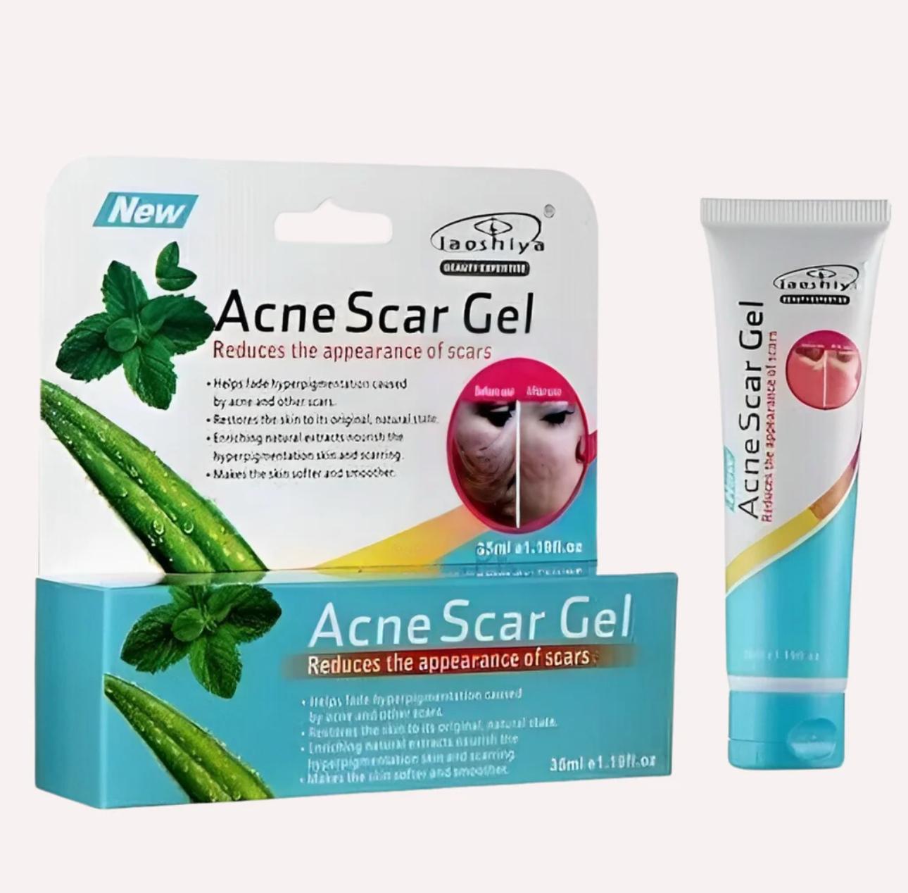 Laoshiya Acne Scar Gel – Natural Scar Fading Treatment for Smooth, Clear Skin (36ml)